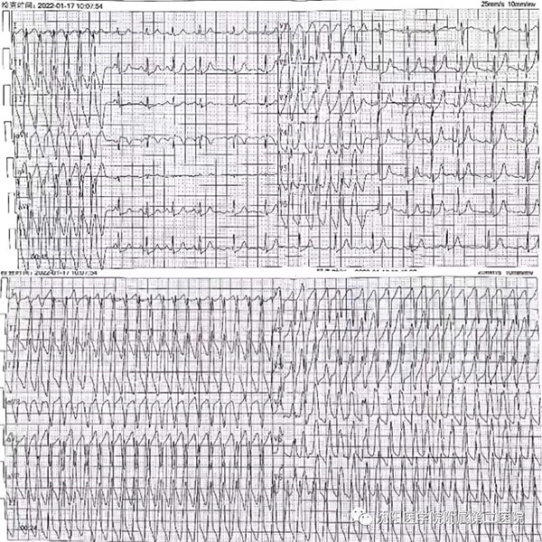 1643517693390999.jpg 1.jpg
